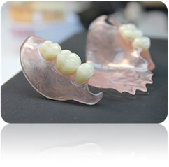 Протезирование при полном и/или частичном отсутствии зубов